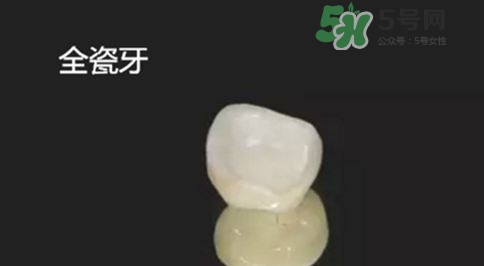 烤瓷牙和全瓷牙有什么區別?烤瓷牙和全瓷牙的區別