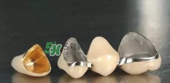烤瓷牙和全瓷牙有什么區別?烤瓷牙和全瓷牙的區別