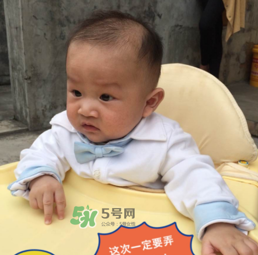 夏季寶寶脫水有什么癥狀 夏季寶寶脫水的表現