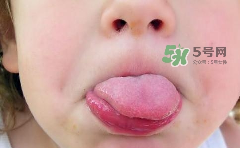 三伏天為什么濕氣重？三伏天為什么要注意祛濕？
