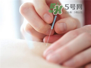 針灸減肥的誤區 針灸減肥注意事項