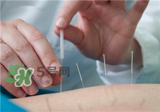 針灸減肥的誤區 針灸減肥注意事項