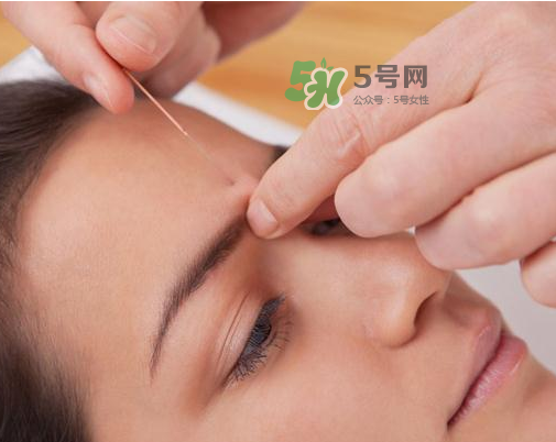 三伏天針灸有什么好處？三伏天針灸注意什么？