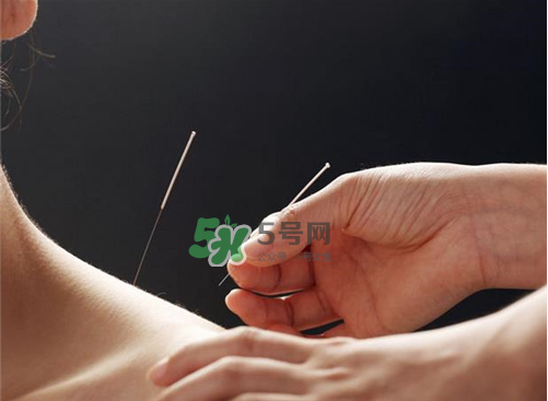 三伏天針灸有什么好處？三伏天針灸注意什么？