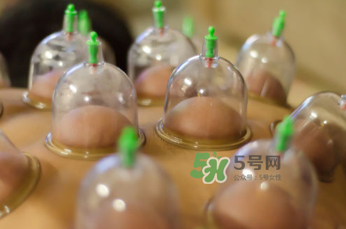 拔火罐是夏天好還是冬天好？什么時候拔火罐最合適？
