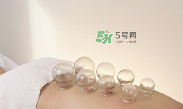 拔火罐是夏天好還是冬天好？什么時候拔火罐最合適？
