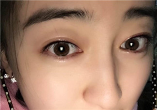 做美瞳線會不會掉睫毛？做美瞳線掉睫毛怎么辦？