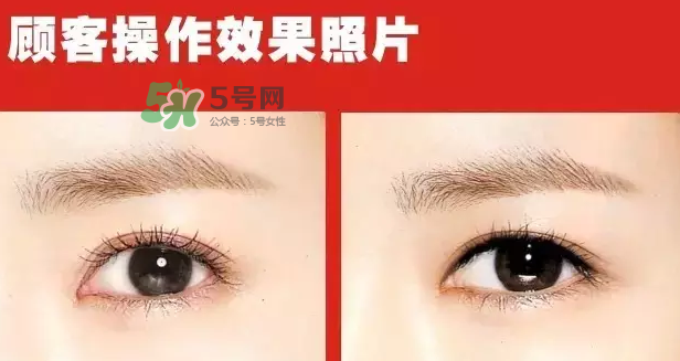 美瞳線有必要做嗎？做美瞳線多少錢？