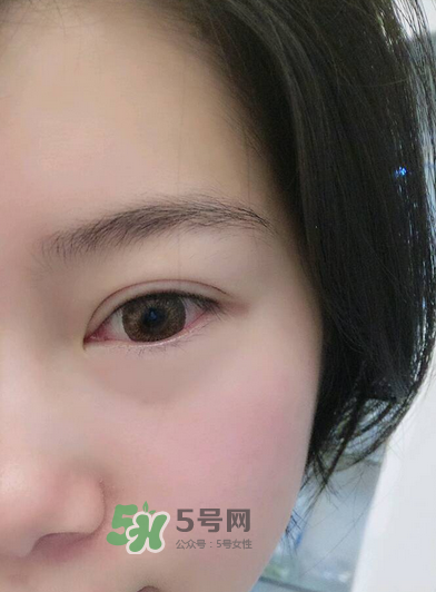 做美瞳線疼嗎？做美瞳線后要注意什么？
