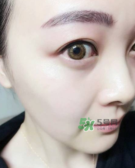 做美瞳線對眼睛有傷害嗎？做美瞳線會傷眼睛嗎？