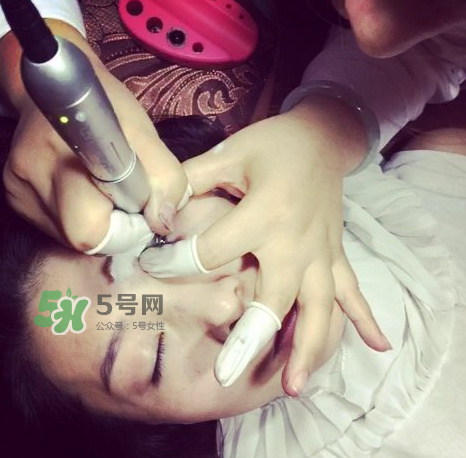做美瞳線要打麻藥嗎？做美瞳線麻藥怎么敷？