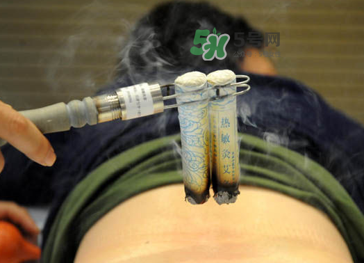 三伏天艾灸后能吹空調嗎？三伏天艾灸后能吹電扇嗎？