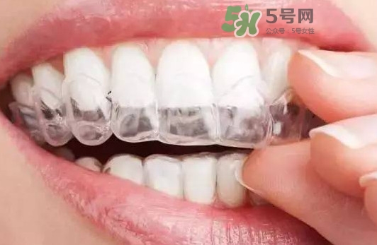 牙齒有縫隙可以補嗎？牙齒縫隙大能補嗎