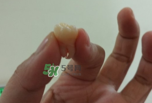 拔智齒痛嗎？智齒拔了多久洞會好？