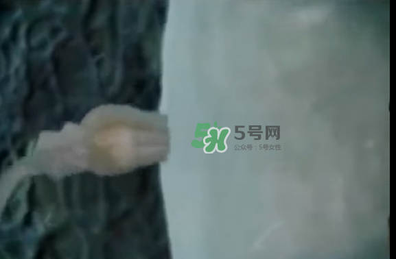 懷孕初期怎么保胎？陰道出血是流產(chǎn)征兆嗎？