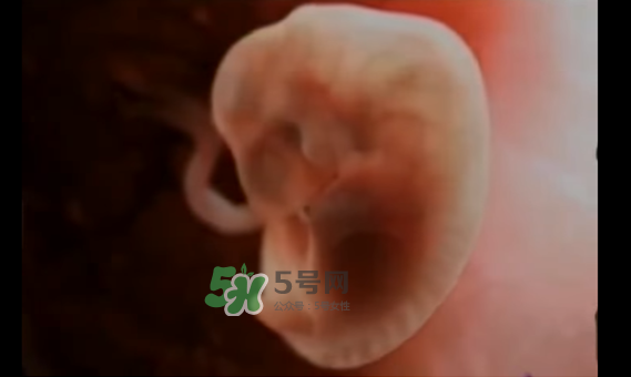 懷孕初期怎么保胎？陰道出血是流產(chǎn)征兆嗎？