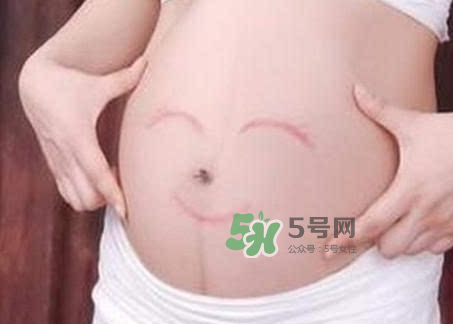 產婦胃脹氣怎么緩解？產婦胃脹氣怎么辦？