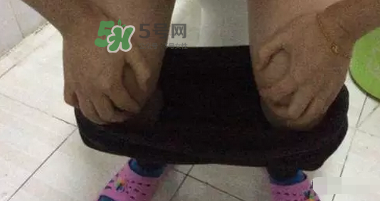 孕期可以蹲著上廁所嗎？孕期上廁所會(huì)壓到寶寶嗎？