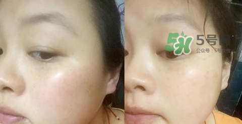 可思美潔面儀好不好用？可思美凈致潔顏聲波潔面儀怎么樣？