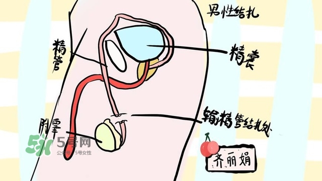 生完二胎一定要結(jié)扎嗎？生完二胎結(jié)扎好不好？