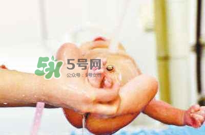 羊水栓塞是醫療事故嗎？羊水栓塞多發生于順產還是剖腹產？