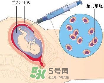 羊水栓塞是怎么回事？羊水栓塞怎么預防？