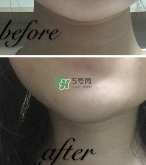olay小白瓶有哪些版本？olay小白瓶版本區別