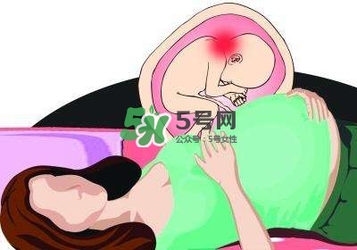 孕婦左側臥睡不著怎么辦？孕期左側睡不舒服怎么辦？