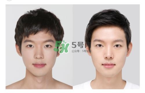 美白針有副作用嗎？美白針有什么副作用？