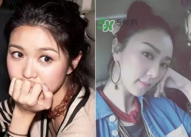 發際線低怎么調整？標準的發際線圖片