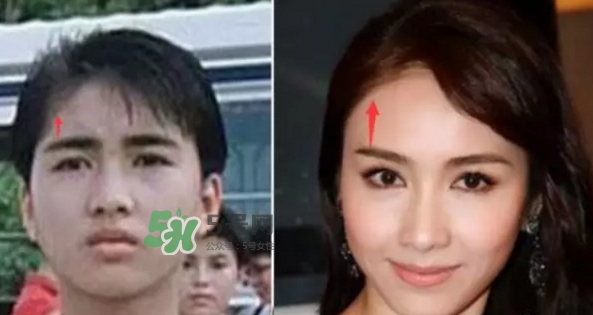 發際線低怎么調整？標準的發際線圖片