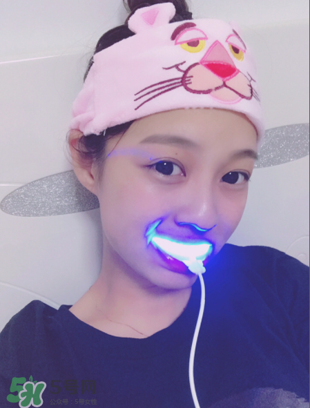 美牙儀能去牙結石嗎？美牙儀對牙結石有效嗎？