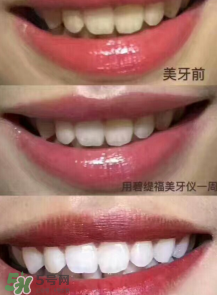 美牙儀能用水洗嗎？美牙儀能用多久？