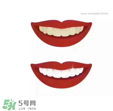 美牙儀能帶上飛機嗎？美牙儀可以過安檢嗎？