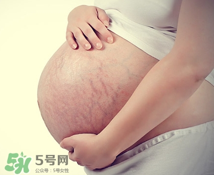 孕婦胸部長妊娠紋嗎？胸部長妊娠紋了怎么辦？