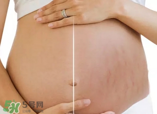 脖子上會長妊娠紋嗎？妊娠紋長在哪些地方？