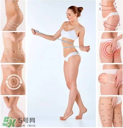 吸脂減肥會反彈嗎？吸脂減肥有沒有后遺癥？