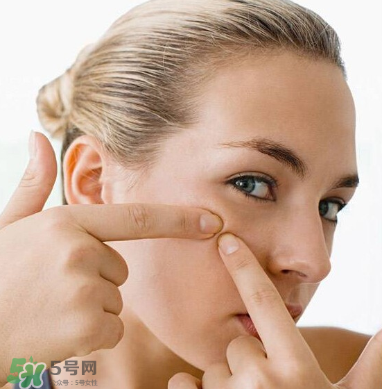 長痘長閉口怎么辦？長痘長閉口是什么原因？