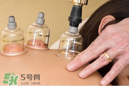 真空拔罐有用嗎？真空拔罐多長時間合適