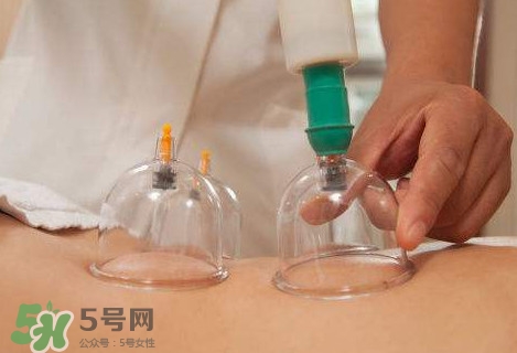 真空拔罐有用嗎？真空拔罐多長時間合適