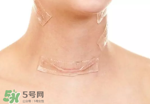 硅膠疤痕貼有用嗎？硅膠疤痕貼效果怎么樣？