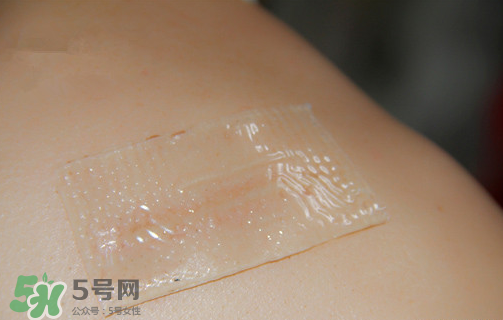 仙卡疤痕貼有用嗎？仙卡疤痕貼效果怎么樣？