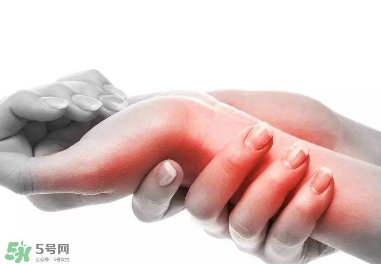 風濕是痛風嗎？風濕跟痛風有什么區別？