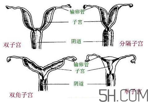 子宮畸形有哪些？子宮畸形有什么影響？