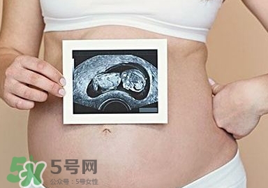 雙子宮可以上環嗎？雙子宮上環要注意哪些？