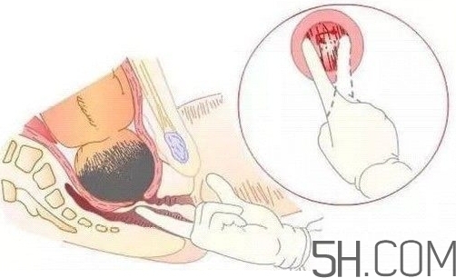 內(nèi)檢是什么感覺(jué)？?jī)?nèi)檢有男醫(yī)生嗎？