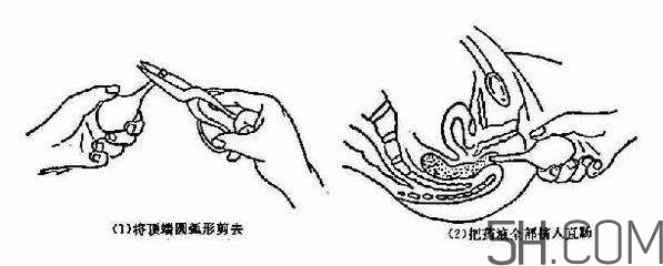 開塞露怎么用？開塞露用后多久會排便？