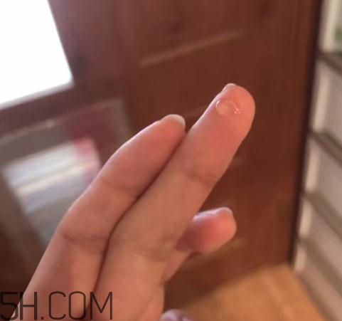 倍舒痕可以去痘印嗎？倍舒痕能涂在痘痘上嗎？