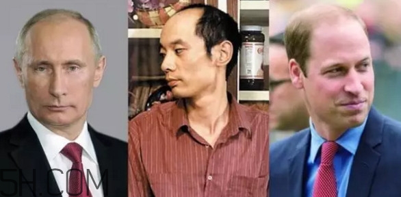 為什么會禿頂？禿頂的人聰明嗎