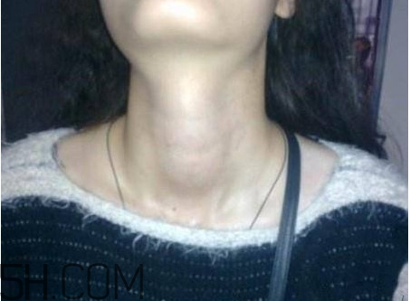 甲狀腺結節掛什么科？甲狀腺結節可以懷孕嗎